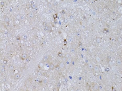Immunohistochemistry - RARA Polyclonal Antibody (144-00370)