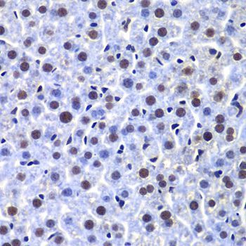 Immunohistochemistry - PRKDC Polyclonal Antibody (144-07716)
