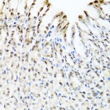 Immunohistochemistry - YTHDF3 antibody (144-08395)