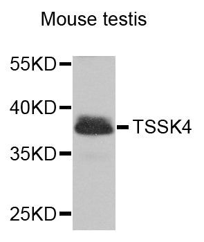 Western blot - TSSK4 antibody (144-07861)