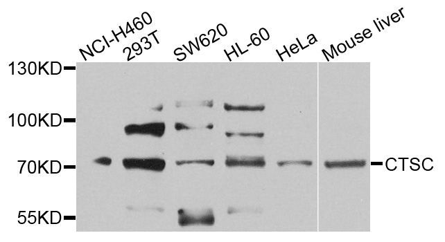 Western blot - CTSC antibody (144-08403)