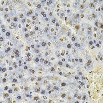 Immunohistochemistry - PSMC3 Antibody (144-01986)