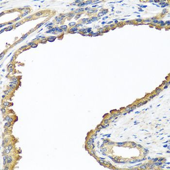Immunohistochemistry - NYX antibody (144-07830)