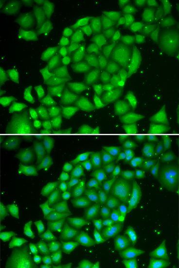 Immunofluorescence - TCL1A Polyclonal Antibody (144-00629)
