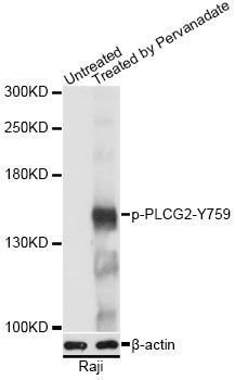 Western blot - Phospho-PLCG2-Y759 pAb (144-61519)