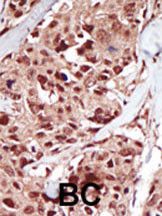 IHC-P