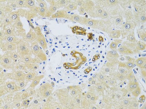 Immunohistochemistry - [KO Validated] RAB27A Polyclonal Antibody (144-01934)
