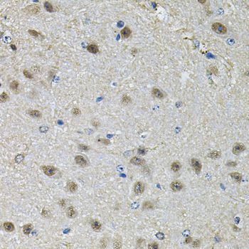 Immunohistochemistry - PPID Polyclonal Antibody (144-06949)