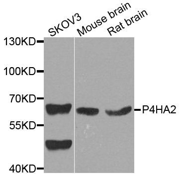 Western blot - P4HA2 antibody (144-04262)