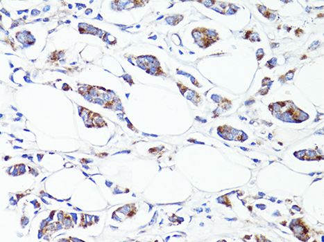 Immunohistochemistry - S100A10 antibody (144-60742)