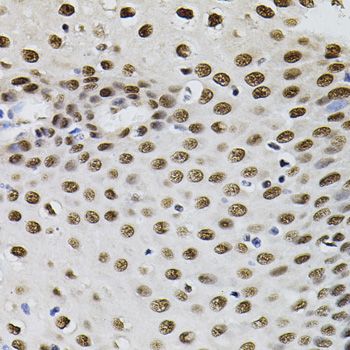 Immunohistochemistry - GTF2I antibody (144-07898)