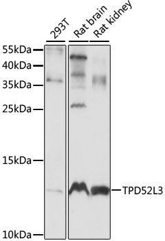 Western blot - TPD52L3 antibody (144-61104)