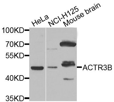 Western blot - ACTR3B antibody (144-07824)