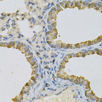 Immunohistochemistry - CDA Polyclonal Antibody (144-013959)