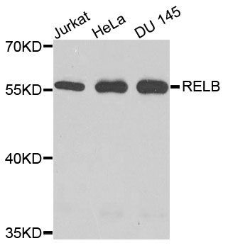 Western blot - RELB Polyclonal Antibody (144-00519)