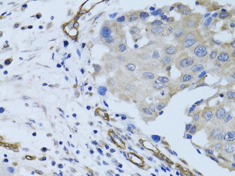Immunohistochemistry - MCAM antibody (144-60521)