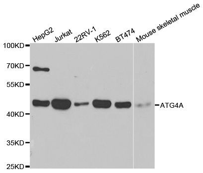 Western blot - ATG4A antibody (144-02598)