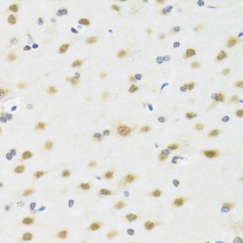 Immunohistochemistry - MTAP Polyclonal Antibody (144-01049)