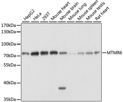 Western blot - MTMR6 antibody (144-61006)