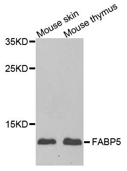 Western blot - FABP5 antibody (144-06373)