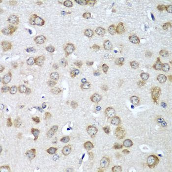 Immunohistochemistry - EIF1AX Polyclonal Antibody (144-05917)