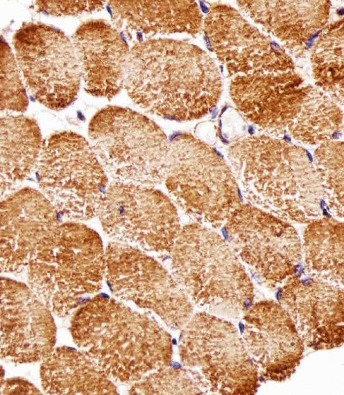 IHC-P