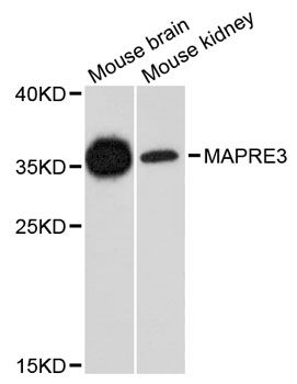 Western blot - MAPRE3 antibody (144-09591)