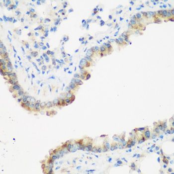 Immunohistochemistry - IGF2BP3 Polyclonal Antibody (144-04444)