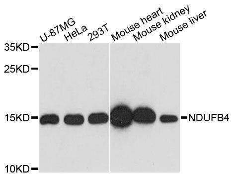 Western blot - [KO Validated] NDUFB4 Polyclonal Antibody (144-60491)