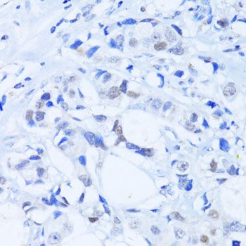 Immunohistochemistry - PARP1 Polyclonal Antibody (144-00942)