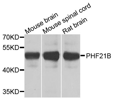 Western blot - PHF21B antibody (144-07849)