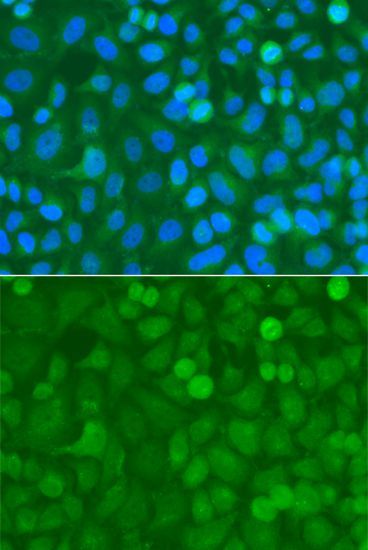 Immunofluorescence - NCK1 Polyclonal Antibody (144-00999)