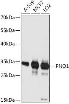 Western blot