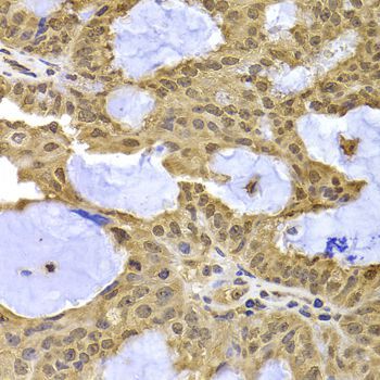 Immunohistochemistry - XPO5 Polyclonal Antibody (144-06790)