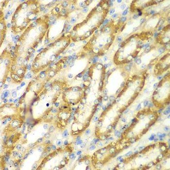 Immunohistochemistry - TM9SF1 Polyclonal Antibody (144-07461)