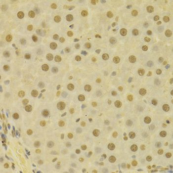 Immunohistochemistry - COPS5 Polyclonal Antibody (144-01766)