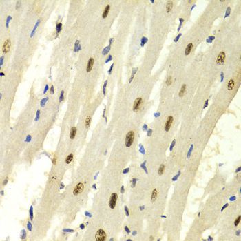 Immunohistochemistry - KPNA4 Antibody (144-02026)