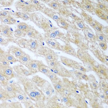 Immunohistochemistry - UCHL3 antibody (144-08156)