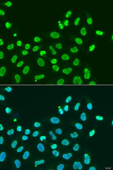 Immunofluorescence - CBX5 antibody (144-12577)