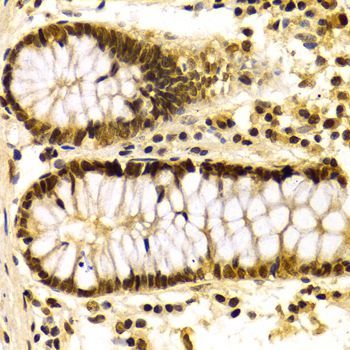Immunohistochemistry - KPNA4 Antibody (144-02026)