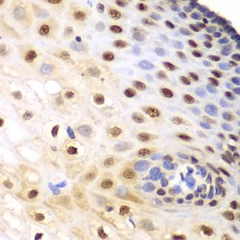 Immunohistochemistry - KPNA1 antibody (144-01742)