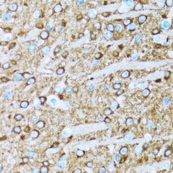 Immunohistochemistry - ENO2 antibody (144-03118)