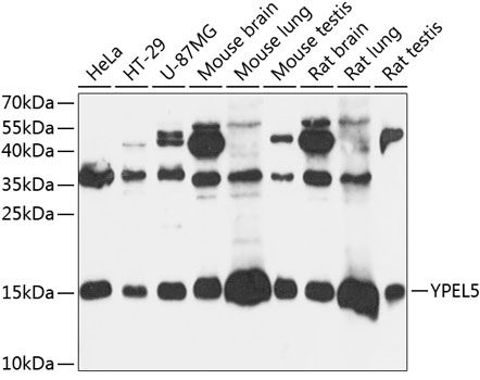 Western blot