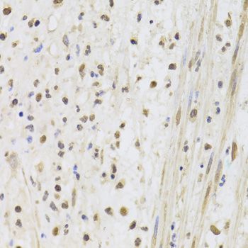 Immunohistochemistry - AAAS Antibody (144-06427)