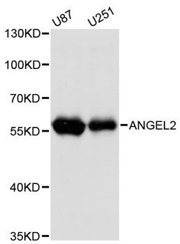 Western blot - ANGEL2 antibody (144-12799)