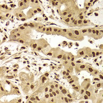 Immunohistochemistry - ANP32A Antibody (144-05768)