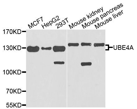 Western blot - UBE4A antibody (144-03354)
