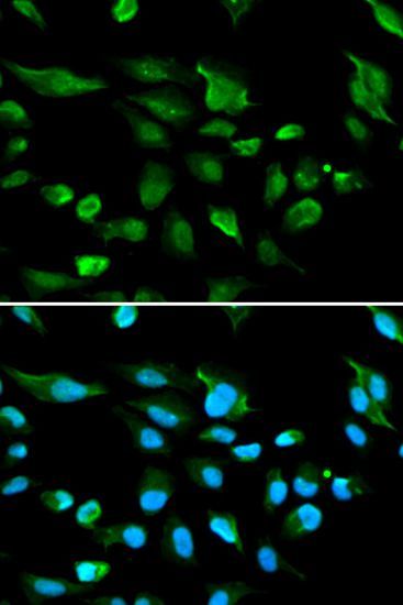 Immunofluorescence - AIRE antibody (144-01767)