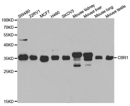 Western blot - CBR1 Polyclonal Antibody (144-05446)