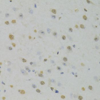 Immunohistochemistry - HNRNPD Polyclonal Antibody (144-01828)